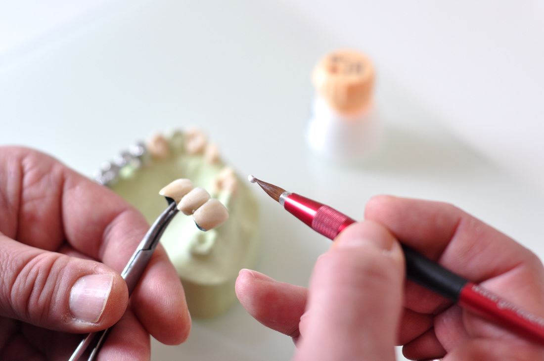 Ästhetik zahntechnischer Restaurationen