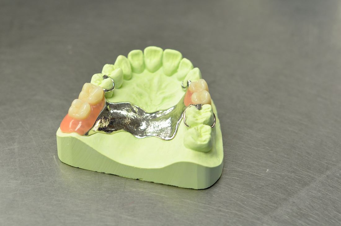 Passgenaue Modellgusstechnik