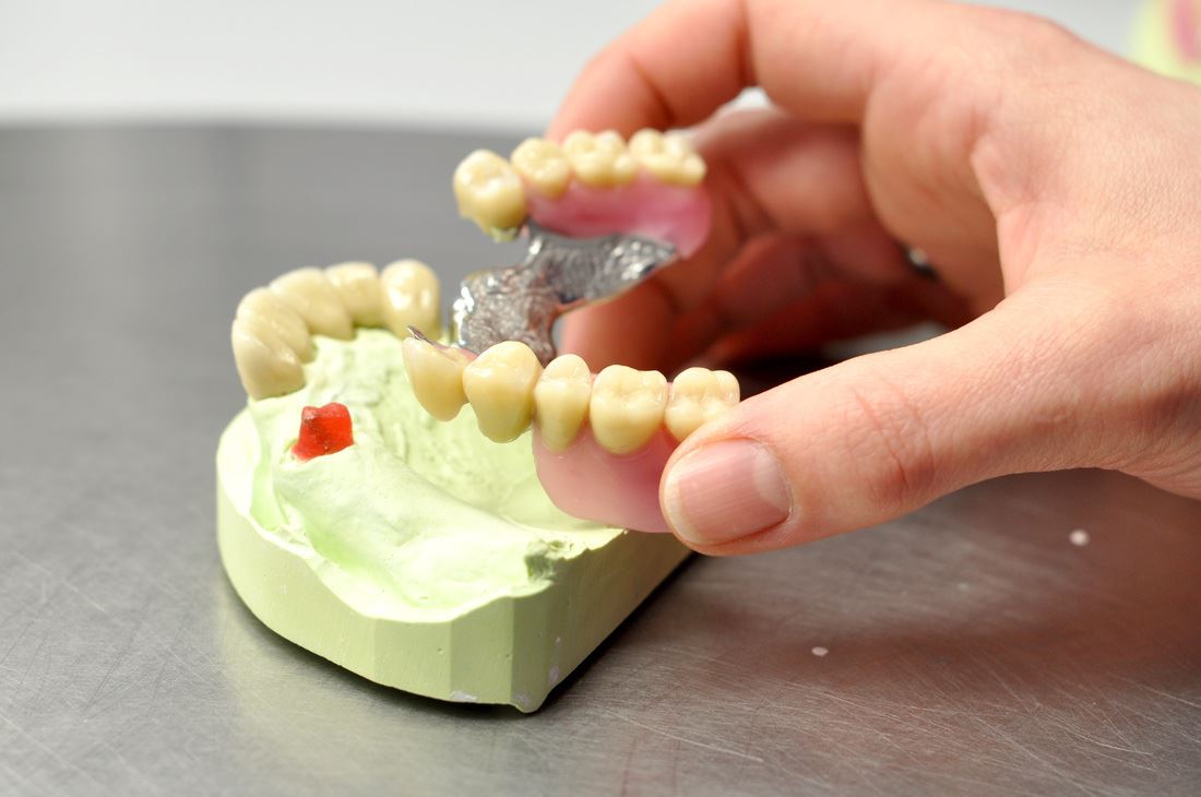 Teleskop- und Geschiebetechnik